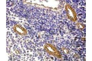 Immunohistochemistry (Formalin/PFA-fixed paraffin-embedded sections) analysis in human tonsil with FOXP3 polyclonal antibody  at 5 ug/mL.