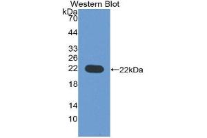 Western Blotting (WB) image for anti-CD276 (CD276) (AA 47-219) antibody (ABIN1867121) (CD276 Antikörper  (AA 47-219))