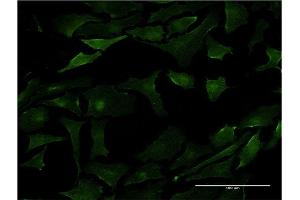 Immunofluorescence of monoclonal antibody to PML on HeLa cell. (PML Antikörper  (AA 411-510))