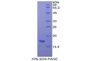 SDS-PAGE (SDS) image for Activin A Receptor, Type IIA (ACVR2A) protein (ABIN3008107)