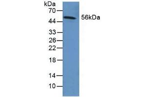 Figure. (Fibrinogen beta Chain Antikörper  (AA 29-118))