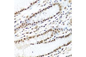 Immunohistochemistry of paraffin-embedded human stomach using METTL3 antibody (ABIN5974672) at dilution of 1/100 (40x lens). (METTL3 Antikörper)