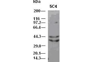 DFF45 antibody (5C4) at 1:5000 dilution + Hela cell lysate (DFFA Antikörper)