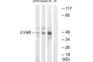 Western blot analysis of extracts from Jurkat/HepG2/LOVO cells, using LYAR Antibody. (LYAR Antikörper  (AA 241-290))