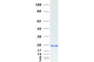Western Blotting (WB) image for SAR1 Homolog B (SAR1B) (Transcript Variant 2) protein (Myc-DYKDDDDK Tag) (ABIN2731398)