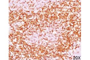 IHC testing of human tonsil (10X) stained with CD6 antibody (C6/372). (CD6 Antikörper)