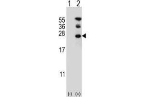 Western blot analysis of RAN antibody and 293 cell lysate either nontransfected (Lane 1) or transiently transfected (2) with the RAN gene. (RAN Antikörper  (AA 12-39))