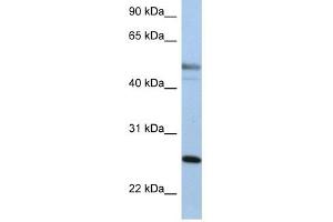 Cytokeratin 8 antibody used at 1 ug/ml to detect target protein. (KRT8 Antikörper  (Middle Region))