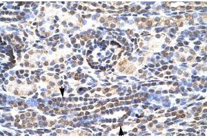 Human kidney; Rabbit Anti-KL9 Antibody. (KLF9 Antikörper  (N-Term))