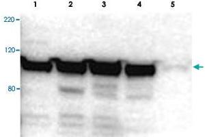 Western blot using MYO1G polyclonal antibody  shows detection of a band ~100 kDa in size corresponding to MYO1G (arrowhead) in MYO1G positive whole cell lysate. (MYO1G Antikörper  (Internal Region))