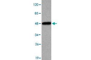 Western blot analysis of KDM3A monoclonal antibody  at 1 : 2000 dilution interacts with recombinant KDM3A protein with a His tag. (KDM3A Antikörper  (N-Term))
