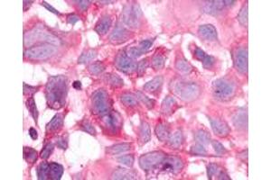 Immunocytochemistry (ICC) image for anti-Histamine Receptor H3 (HRH3) (Cytoplasmic Domain) antibody (ABIN1048962)
