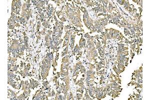 IHC analysis of ERp57 using anti-ERp57 antibody (ABIN7602778).