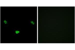 Immunofluorescence analysis of LOVO cells, using HNF4 alpha (Phospho-Ser313) Antibody. (HNF4A Antikörper  (pSer313))