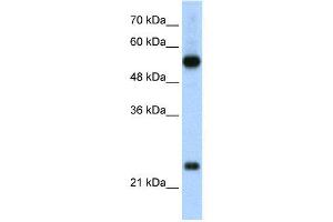 WB Suggested Anti-RPL13  Antibody Titration: 2. (RPL13 Antikörper  (C-Term))