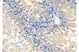 ABIN6264759 and ABIN6278629 at 1/100 staining Rat testis tissue by IHC-P. (RIOK3 Antikörper  (Internal Region))