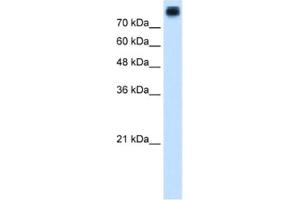 Western Blotting (WB) image for anti-P-Cadherin (CDH3) antibody (ABIN2462833) (P-Cadherin Antikörper)