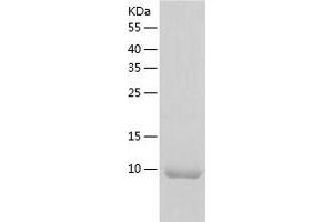 Western Blotting (WB) image for Eukaryotic Translation Initiation Factor 1 (EIF1) (AA 1-113) protein (His tag) (ABIN7122833)