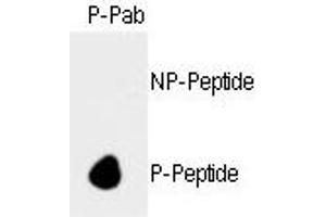 Dot blot analysis of anti-hRb- Phospho-specific Pab (ABIN389645 and ABIN2839637) on nitrocellulose membrane. (Retinoblastoma 1 Antikörper  (pSer788))
