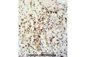 Immunohistochemistry (IHC) image for anti-HAUS Augmin-Like Complex, Subunit 5 (HAUS5) antibody (ABIN3002272) (HAUS5 Antikörper)
