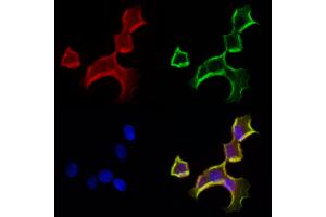 ABIN6262995 and ABIN6272963 staining Hela cells by IF/ICC. (LONP1 Antikörper  (C-Term))