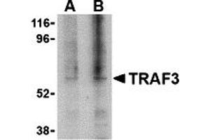 Western Blotting (WB) image for anti-TNF Receptor-Associated Factor 3 (TRAF3) (C-Term) antibody (ABIN1030765) (TRAF3 Antikörper  (C-Term))