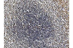 IHC analysis of RRS1 using anti-RRS1 antibody (ABIN7601344). (RRS1 Antikörper  (AA 33-266))