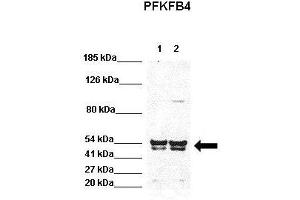 WB Suggested Anti-PFKFB4 Antibody  Positive Control: Lane 1:441 µg HEK293 lysate Lane 2: 041 µg H1299 lysate Primary Antibody Dilution: 1:0000Secondary Antibody: Goat anti-rabbit-HRP Secondry  Antibody Dilution: 1:0000Submitted by: Jose Luis Rosa, Universitat de Barcelona