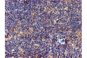 Image no. 7 for anti-NADH Dehydrogenase (Ubiquinone) Complex I, Assembly Factor 7 (NDUFAF7) antibody (ABIN1499667) (NDUFAF7 Antikörper)