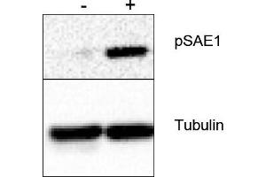 Image no. 1 for anti-SUMO1 Activating Enzyme Subunit 1 (SAE1) (Ser185) antibody (ABIN401467) (SAE1 Antikörper  (Ser185))