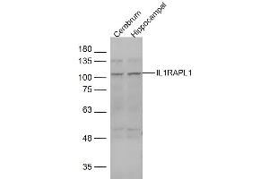 Lane 1: mouse cerebrum Lane 2: mouse hippocampal lysates probed with IL1RAPL1 Polyclonal Antibody, Unconjugated  at 1:1000 dilution and 4˚C overnight incubation. (IL1RAPL1 Antikörper  (AA 301-400))