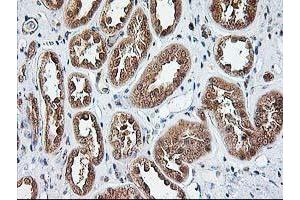 Immunohistochemical staining of paraffin-embedded Human Kidney tissue using anti-NUDT9 mouse monoclonal antibody. (NUDT9 Antikörper)