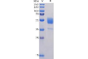 SDS-PAGE (SDS) image for Tetraspanin 26 (TSPAN26) (AA 112-241) protein (Fc Tag) (ABIN6961141)