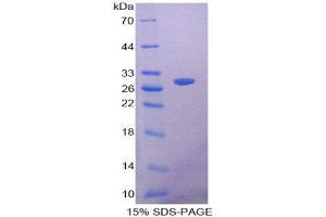 SDS-PAGE (SDS) image for Signal-Regulatory Protein beta 1 (SIRPB1) (AA 127-356) protein (His tag) (ABIN2126754)