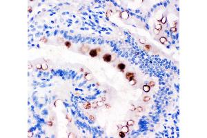 Anti-Estrogen Inducible Protein pS2 antibody, IHC(P) IHC(P): Rat Intestine Tissue