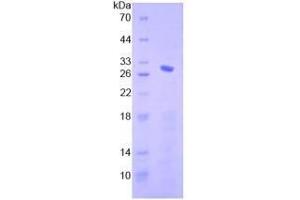 SDS-PAGE analysis of Human Smad4 Protein.