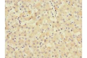 Immunohistochemistry of paraffin-embedded human liver tissue using ABIN7159906 at dilution of 1:100 (TIMM5 (AA 87-353) Antikörper)