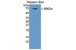 Detection of Recombinant SEMA4D, Rat using Polyclonal Antibody to Semaphorin 4D (SEMA4D) (SEMA4D/CD100 Antikörper  (AA 145-494))