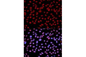 Immunofluorescence analysis of U2OS cells using IFIH1 antibody (ABIN5971229). (IFIH1 Antikörper)