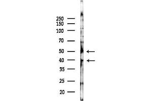 anti-B-Cell CLL/lymphoma 7A (BCL7A) (C-Term) antibody