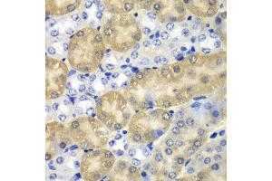 Immunohistochemistry of paraffin-embedded mouse kidney using AMY1A antibody at dilution of 1:100 (x40 lens).