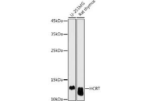 Western blot analysis of extracts of various cell lines, using HCRT antibody (ABIN6128406, ABIN6141654, ABIN6141655 and ABIN6225128) at 1:500 dilution. (Orexin Antikörper  (AA 34-131))