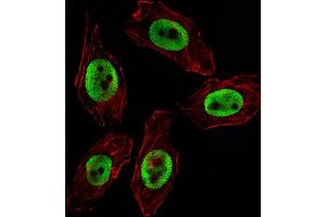 Immunofluorescence (IF) image for anti-Enhancer of Zeste Homolog 2 (EZH2) antibody (ABIN2995316) (EZH2 Antikörper)
