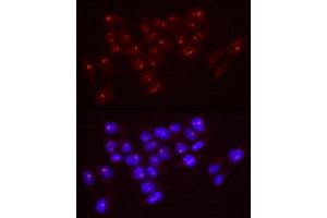 Immunofluorescence analysis of HeLa cells using Nucleolin antibody (ABIN7269035) at dilution of 1:50 (40x lens). (Nucleolin Antikörper)