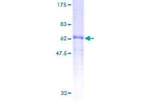 DRG2 Protein (AA 1-364) (GST tag)