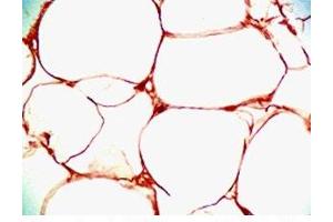Immunohistochemistry (IHC) image for anti-serpin Peptidase Inhibitor, Clade A (Alpha-1 Antiproteinase, Antitrypsin), Member 12 (SERPINA12) (AA 63-104) antibody (ABIN2872791)
