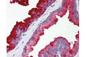 Anti-RAB23 antibody IHC of human prostate. (RAB23 Antikörper  (AA 35-84))