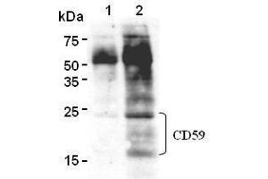 Western Blotting (WB) image for anti-CD59 (CD59) antibody (ABIN1449269) (CD59 Antikörper)