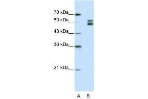 WB Suggested Anti-MSH2 Antibody Titration:  1. (MSH2 Antikörper  (N-Term))
