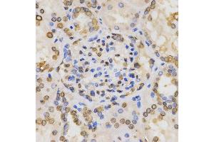 Immunohistochemistry of paraffin-embedded human kidney tissue using H3K36me2 antibody at dilution of 1:200 (x400 lens)